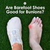 Are Barefoot Shoes Good for Bunions?